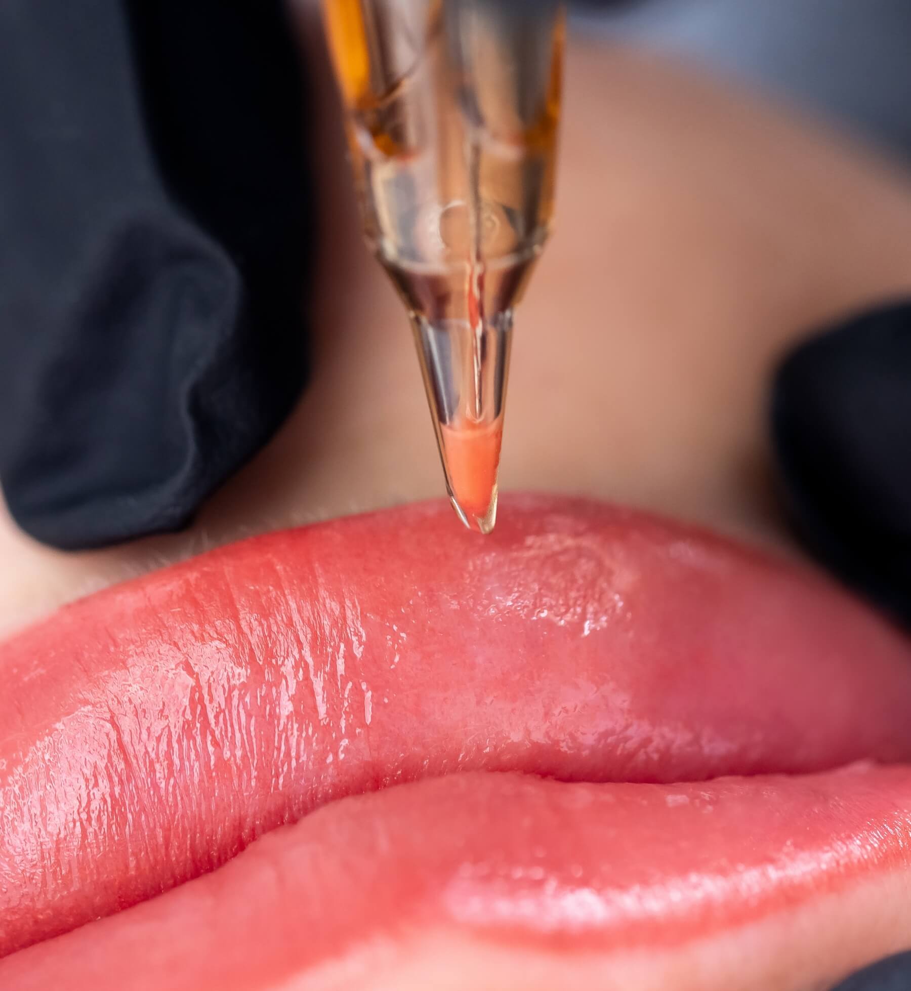 Detailed view of a lip micropigmentation procedure, highlighting the skillful work of a Bonita Hub specialist in Boston.