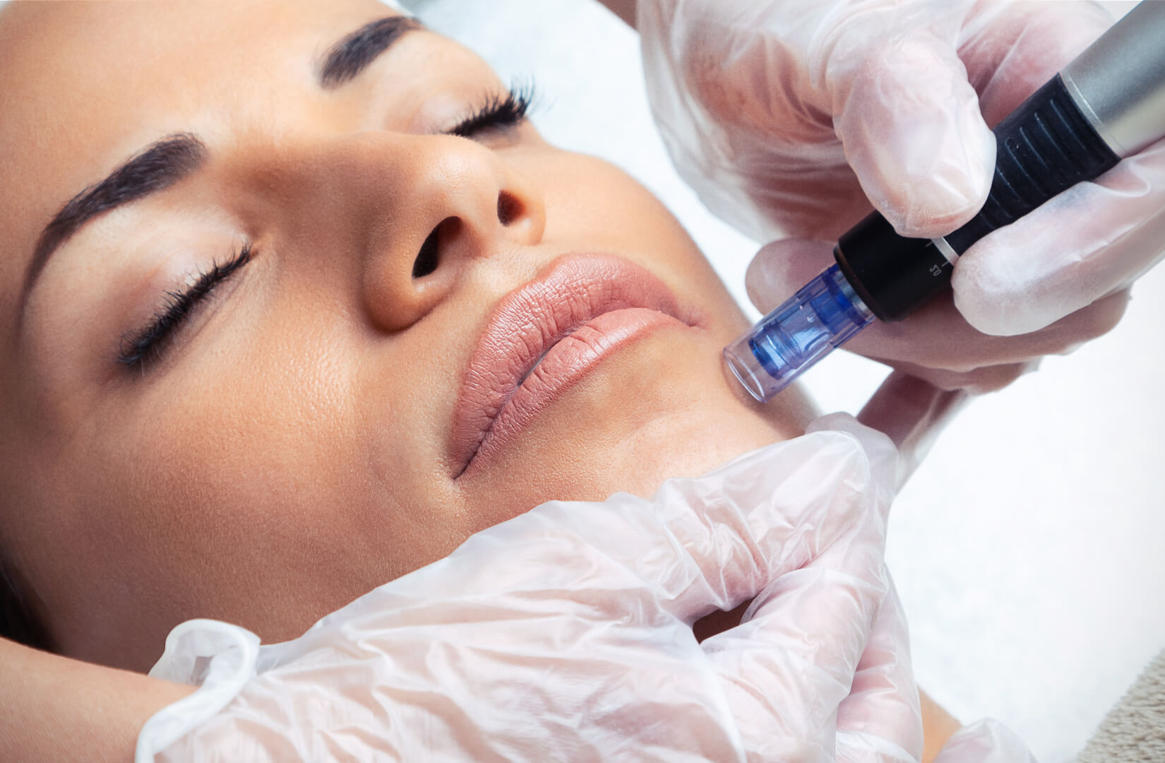 Woman making a microneedling procedure